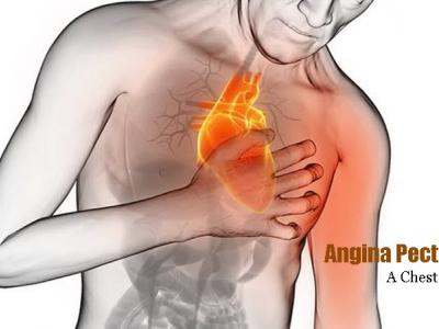 organ-organ-yang-menjadi-sasaran-hipertensi-3.jpg